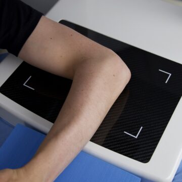 An elbow on top of a 3D scanner
