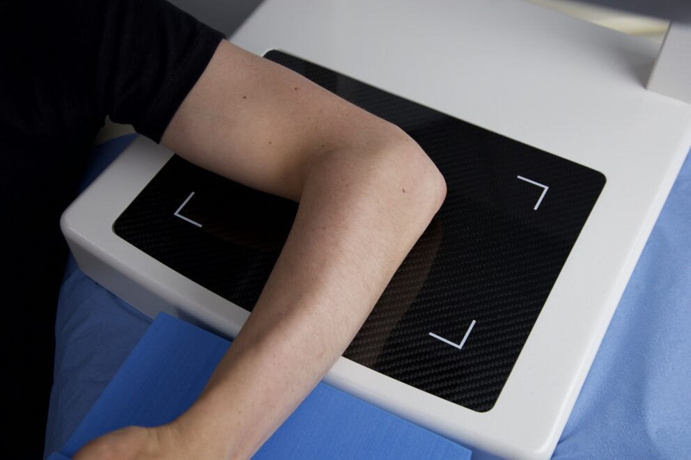 An elbow on top of a 3D scanner